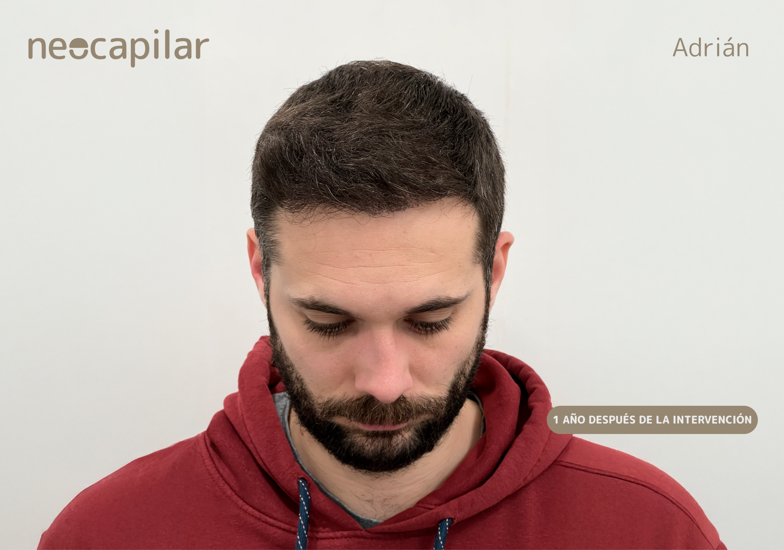 DESPUÉS