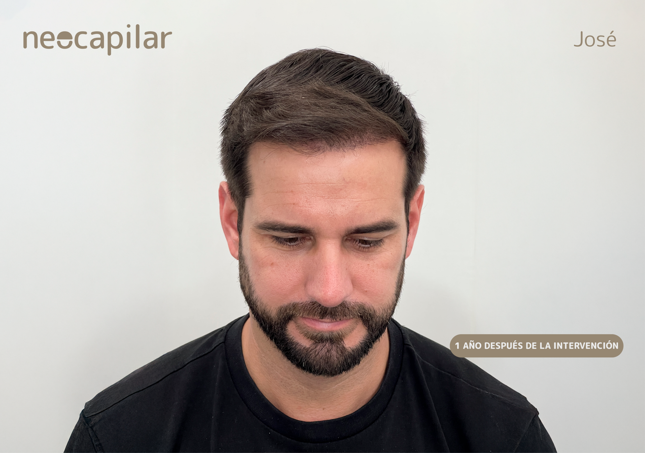 DESPUÉS