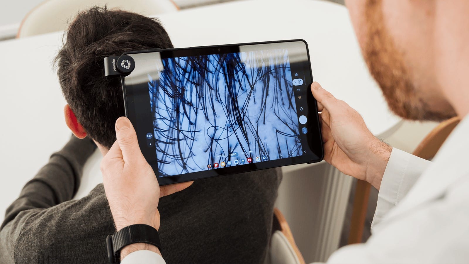 ¿Caída del cabello y pérdida de densidad? ¡Tu diagnóstico médico capilar te espera en Neocapilar!
